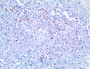 cd3, anti cd3, anti-cd3, CCND3, anti-cyclin D3, anti cyclin D3, anti CCND3, anti-CCND3, cyclin D3 MAIN
