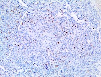 cd3, anti cd3, anti-cd3, CCND3, anti-cyclin D3, anti cyclin D3, anti CCND3, anti-CCND3, cyclin D3 MAIN