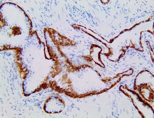 Cytokeratin 5 & 6 (RM341), RMab MAIN