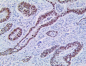 EZH2 (RBT-EZH2), RMab MAIN