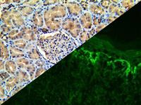 Fibrinogen (Polyclonal), RPab MAIN