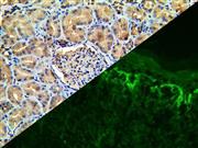 Fibrinogen (Polyclonal), RPab THUMBNAIL