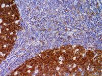 hGAL / GCET2 (EP316), RMab MAIN