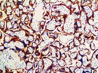 hPL (EP241), RMab MAIN