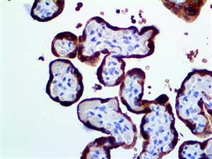 hPL (Polyclonal), RPab MAIN