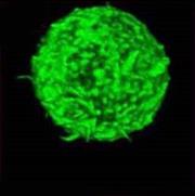 IgE/FITC (Polyclonal), RPab THUMBNAIL