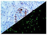 IgM (BSB-41), MMab MAIN