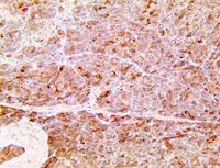 Lrg1, Lrg, Lrhg, leucine rich alpha 2 glycoprotein, anti-lrg1, anti lrg1 MAIN