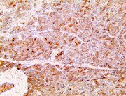 Lrg1, Lrg, Lrhg, leucine rich alpha 2 glycoprotein, anti-lrg1, anti lrg1 THUMBNAIL