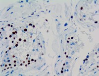 magec2, anti-magec2, anti magec2, melanoma antigen family C 2, CT10, HCA587, MAGEE1, MAGE C2 knockout, MAGE C2 hdr MAIN