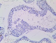 MDM2 (RBT-MDM2), RMab THUMBNAIL