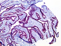 PolyDetector HRP Mulberry MAIN