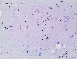 Myeloperoxidase / MPO (BSB-180), MMab MAIN