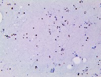 Myeloperoxidase / MPO (BSB-180), MMab MAIN