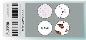 3-Core Neuroblastoma Cell Line Microarray MAIN