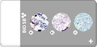 Gram Positive & Gram Negative Bacteria TMA, Artificial (2-core: Positive and Negative), 5 slides MAIN