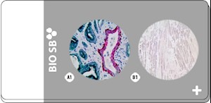 2-Tissue Human PIN TMA, 5 slides MAIN