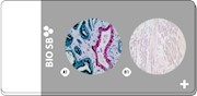 2-Tissue Human PIN TMA, 5 slides THUMBNAIL