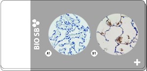 Treponema TMA, Artificial 2-Tissue: Positive and Negative, 5 slides MAIN