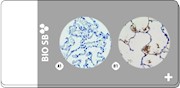 Treponema TMA, Artificial 2-Tissue: Positive and Negative, 5 slides THUMBNAIL