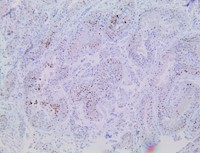 nut, anti-nut, anti nut, nutm1, anti-nutm1, anti nutm1, nuclear protein in testis Nut MAIN