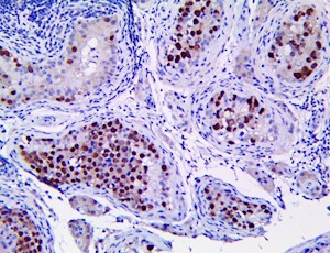 OCT4 / POU5F1 (RBT-OCT4), RMab MAIN