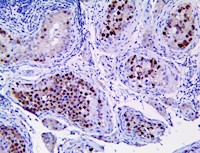 OCT4 / POU5F1 (RBT-OCT4), RMab MAIN