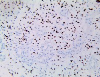 OLIG2 (RBT-OLIG2), RMab MAIN