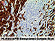 p16  (16P04, JC2), MMab SWATCH