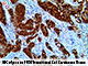 p16  (16P04, JC2), MMab SWATCH