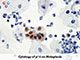 p16 (RM267), RMab SWATCH