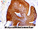 p16 (RM267), RMab SWATCH