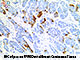 p16 (RM267), RMab SWATCH