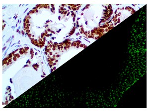 p40 antibody, p-40, p 40, anti-p40, anti-p-40, anti-p 40, anti p40, anti p-40, anti p 40, IL 12B p40, IL12B p40, MAIN