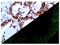 p40 antibody, p-40, p 40, anti-p40, anti-p-40, anti-p 40, anti p40, anti p-40, anti p 40, IL 12B p40, IL12B p40, MAIN