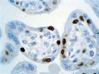 p57 (Kp10), MMab MAIN