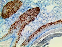 TintoFast p63 (4A4), MMab MAIN