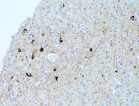 p Tau, phospho Tau, phosphorylated Tau, p- Tau, pTau, anti p Tau, anti p-Tau, anti pTau MAIN