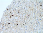 p Tau, phospho Tau, phosphorylated Tau, p- Tau, pTau, anti p Tau, anti p-Tau, anti pTau THUMBNAIL