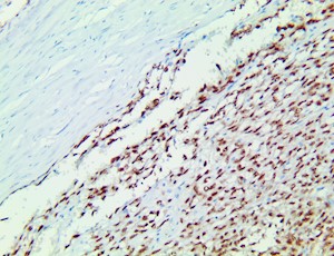 ss18-ssx, anti-ss19-ssx, anti ss18-ssx, SSX1, Protein SSX1, Protein SSX8, Protein SSX9, SSRC, SSX MAIN