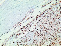 ss18-ssx, anti-ss19-ssx, anti ss18-ssx, SSX1, Protein SSX1, Protein SSX8, Protein SSX9, SSRC, SSX MAIN