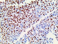 TLE1, anti-TLE1, anti TLE1, Enhancer of split groucho-like protein 1 (ESG1),  Tle4l MAIN