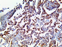 tmprss2, tmp-rss2, anti-tmprss2, Transmembrane Serine Protease 2, erg-tmprss2, tmprss2 antibody, tmprss2 ihc, tmprss2 im MAIN