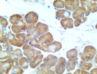 anti-crtc3, anti crtc3, CRTC3, anti-TORC3, anti TORC3, anti-CRTC3, anti CRTC3, TORC 3, TORC3 MAIN