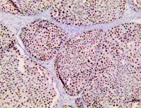 TRPS1, anti-trps1 antibody, anti trps1, TRPS1 shRNA DNA plasmid, TRPS1 shRNA plasmid MAIN