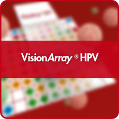 visionarray, hpv chip, high rish hpv, hpv pcr detection