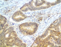 znfand3, anti-znfand3, anti znfand3, AN1 type zinc finger protein 3, TEX27 gene silencer, TEX27 RNAi primers MAIN