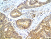 znfand3, anti-znfand3, anti znfand3, AN1 type zinc finger protein 3, TEX27 gene silencer, TEX27 RNAi primers THUMBNAIL