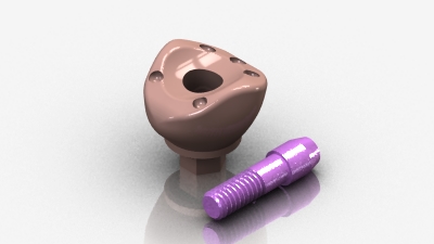 AnatotempSC Healing Abutment 1045-01SC MAIN