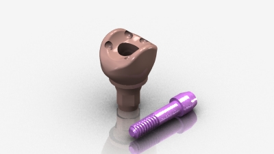 AnatotempSC Healing Abutment 4041-02SC MAIN